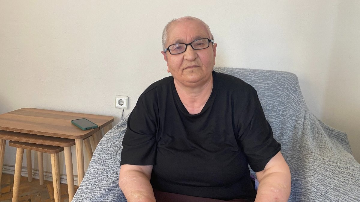 Kırşehir'de köpeğin saldırdığı kadın tazminat alacak: Hakkınızı arayın