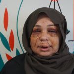 Ankara’da polis eşinden şiddet iddiasıyla şikayetçi oldu