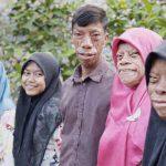 Farklı doğdular, fenomen oldular: Kertenkele Ailesi’nin hikayesi