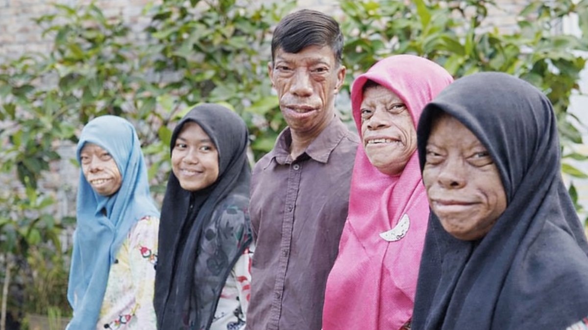 Farklı doğdular, fenomen oldular: Kertenkele Ailesi’nin hikayesi