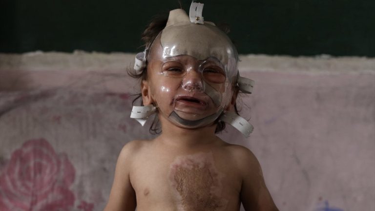 İsrail saldırılarında ağır yaralanan çocuk tedavi bekliyor