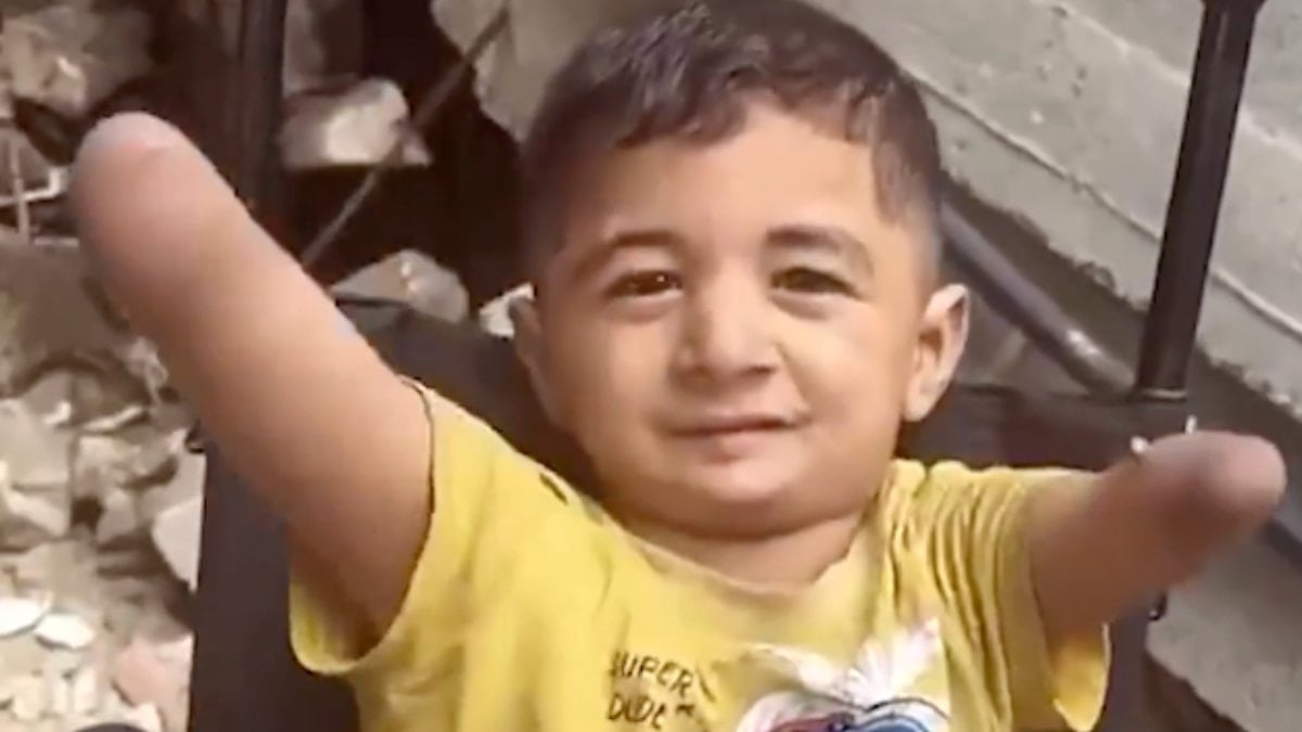 İsrail zulmünün utanç karesi: Gazzeli küçük Amir, uzuvlarını kaybetti