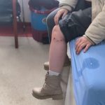 Kayseri’de sokak köpeğinin saldırdığı çocuk yaralandı