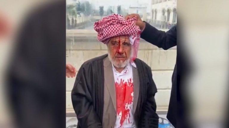 Şanlıurfa’da 72 yaşındaki adam sopalarla darbedildi