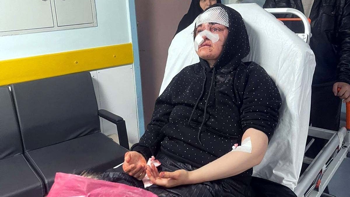 Gaziantep’te boşanma aşamasındaki karısını kaldırım taşıyla dövdü