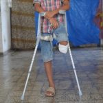 Gazze’de ampute ikizler tedaviye ulaşamıyor