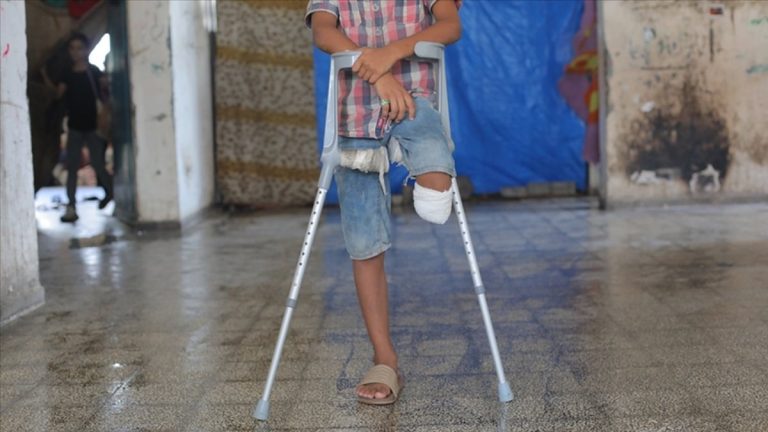 Gazze’de ampute ikizler tedaviye ulaşamıyor