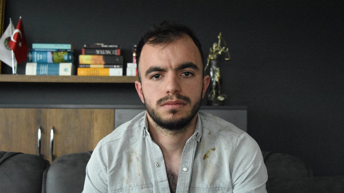 İstanbul’da başına metal parçası saplandı