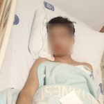 Antalya’da akran zorbalığına uğrayan çocuğun çenesi kırıldı