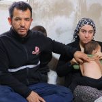 Kahramanmaraş’ta bebeğin belinden zımba çıktı