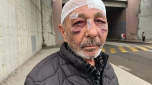 Kocaeli’de çakmak istedikten sonra darbettiler