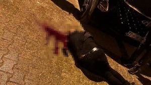 Şırnak’ta yürürken başından vuruldu