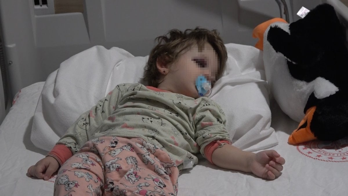 Yalova’da komşuların gürültü kavgasında 14 aylık bebek darbedildi