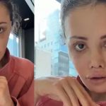 Yüz nakli yaptırmıştı! Didem Ceran kansere yakalandı