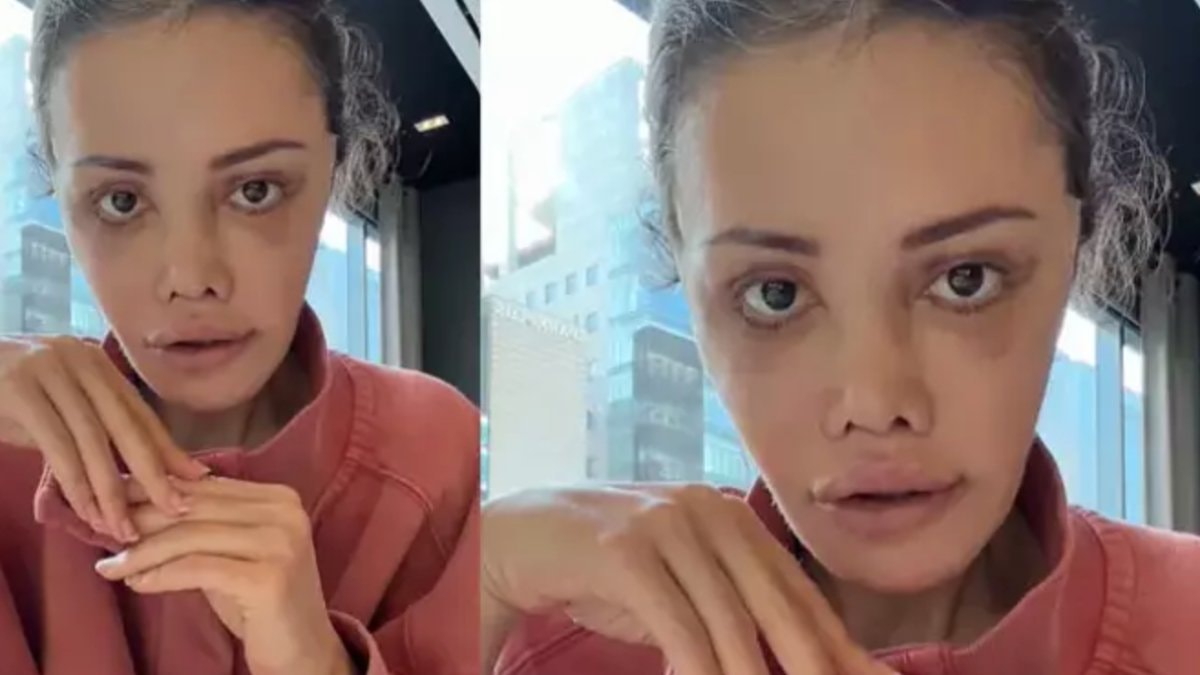 Yüz nakli yaptırmıştı! Didem Ceran kansere yakalandı