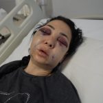 Kocaeli’de gittikleri kafede anne ve oğlu darbedildi