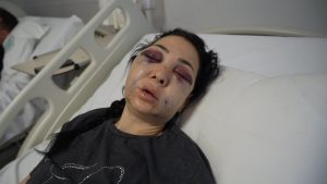 Kocaeli’de gittikleri kafede anne ve oğlu darbedildi