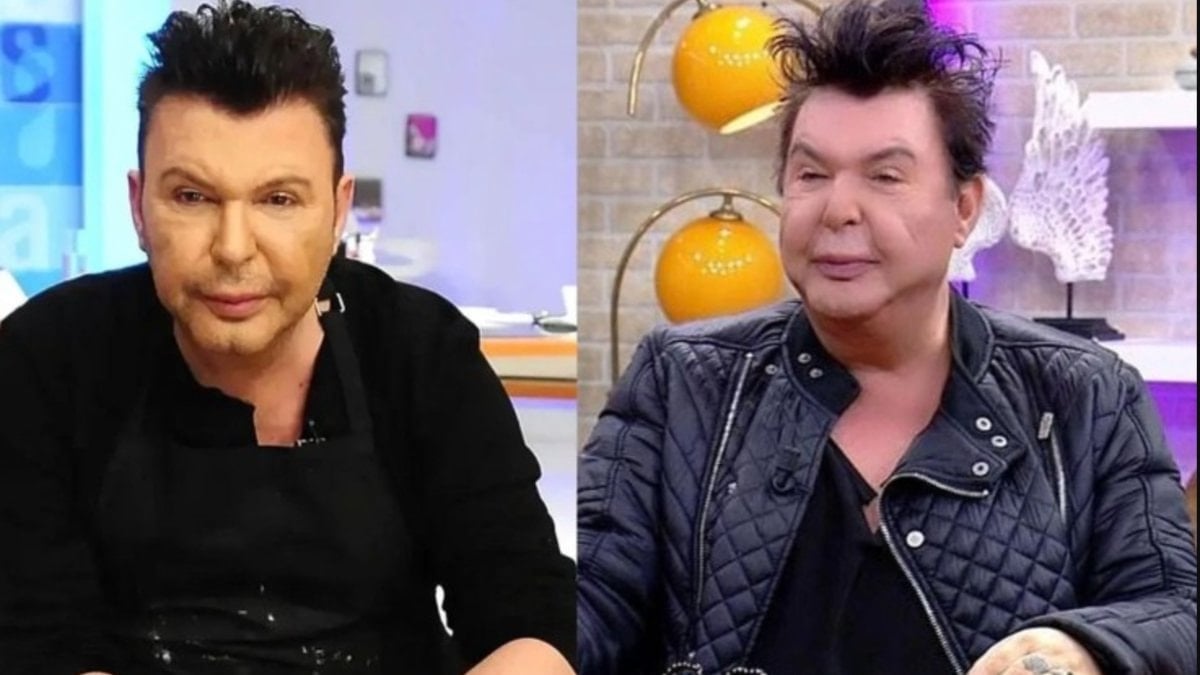 Yüzü deforme olmuştu! Kuşum Aydın’ın ameliyat oldu